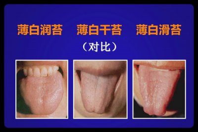 ​舌诊不难：舌苔中的白苔、黄苔和灰黑苔
