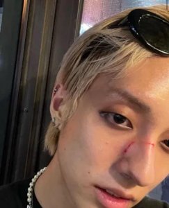 ​公开出柜的韩国歌手，Holland在梨泰院遭到暴力殴打