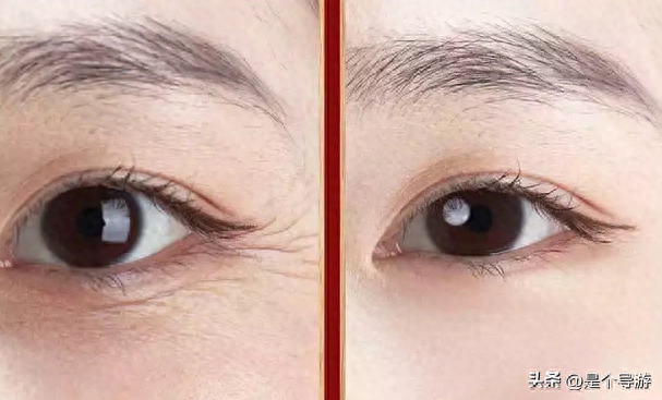 防皱抗衰老的护肤品排行(抗皱去皱最好方法？)