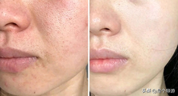 防皱抗衰老的护肤品排行(抗皱去皱最好方法？)