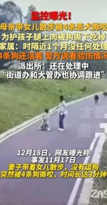 ​后续！母女散步被四条猎犬撕咬近三分钟，腿上的肉都咬下来了！