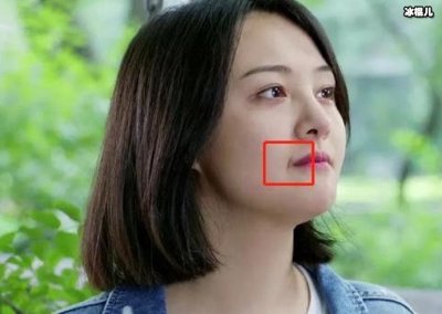 ​郑爽嘴角伤疤是怎么弄到的，知道真相的网友坐不住了