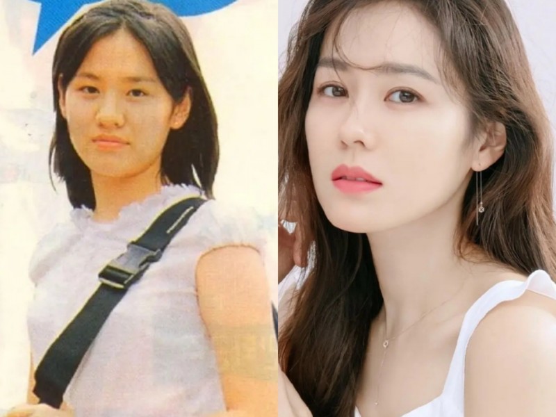 孙艺珍整容前(孙艺珍被质疑整容痕迹明显起热议)