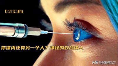 ​你体内还存在另一个人？神秘的嵌合体人