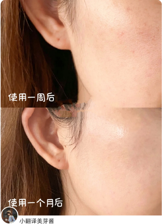 早c晚a护肤品推荐（早C晚A王炸组合分享）